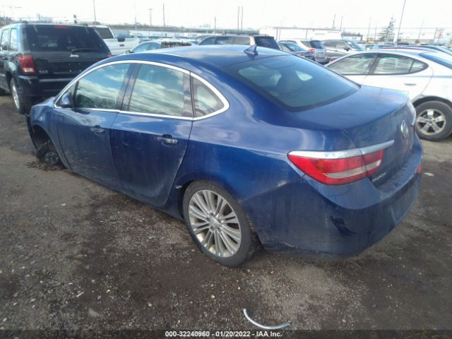 Photo 2 VIN: 1G4PP5SK4E4149769 - BUICK VERANO 