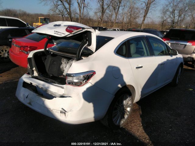 Photo 3 VIN: 1G4PP5SK7E4171524 - BUICK VERANO 