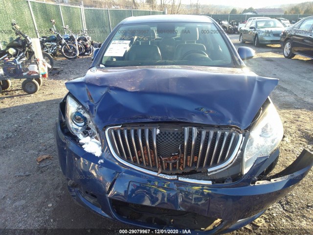 Photo 5 VIN: 1G4PP5SK8D4140281 - BUICK VERANO 