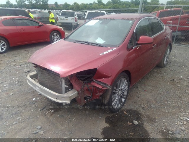 Photo 1 VIN: 1G4PP5SK9D4206322 - BUICK VERANO 