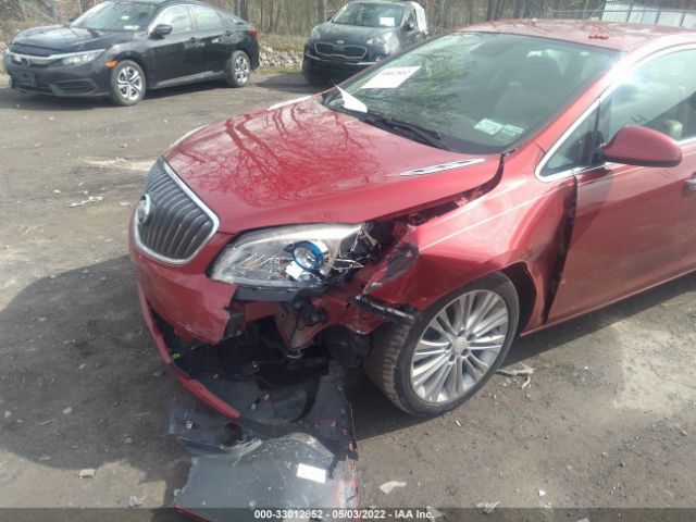 Photo 5 VIN: 1G4PP5SK9D4255441 - BUICK VERANO 