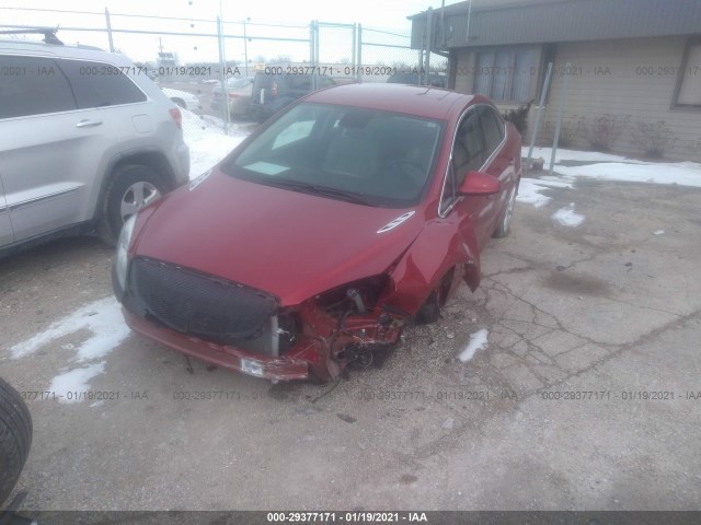 Photo 1 VIN: 1G4PP5SKXD4231827 - BUICK VERANO 