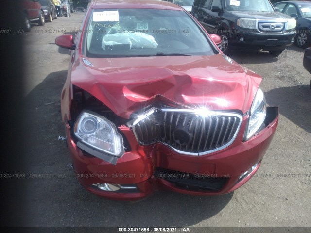 Photo 5 VIN: 1G4PP5SKXE4111785 - BUICK VERANO 