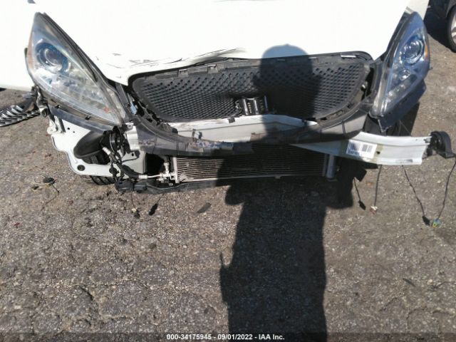 Photo 5 VIN: 1G4PR5SK0H4104035 - BUICK VERANO 