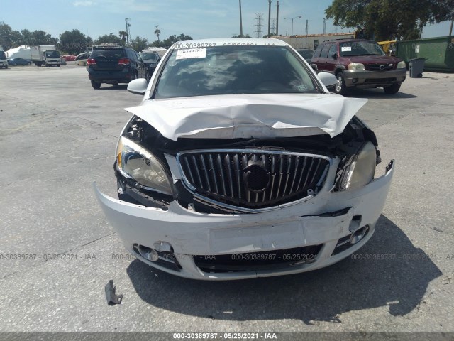 Photo 5 VIN: 1G4PR5SK1E4117419 - BUICK VERANO 