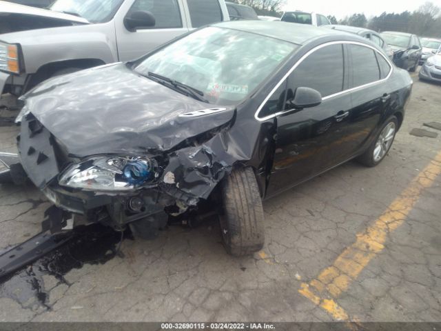 Photo 1 VIN: 1G4PR5SK1E4218962 - BUICK VERANO 