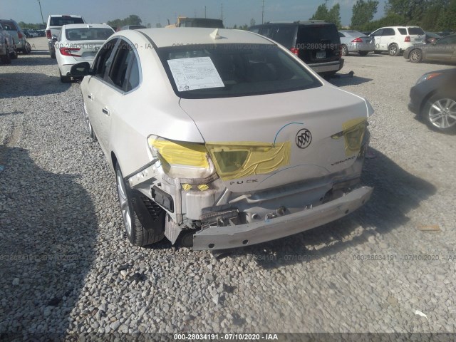 Photo 5 VIN: 1G4PR5SK2C4228879 - BUICK VERANO 