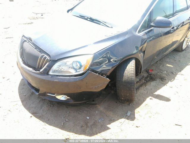 Photo 5 VIN: 1G4PR5SK3G4111687 - BUICK VERANO 