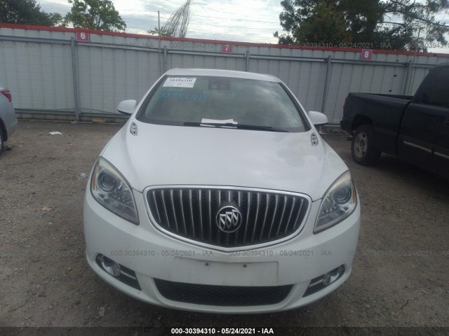 Photo 5 VIN: 1G4PR5SK4E4207955 - BUICK VERANO 