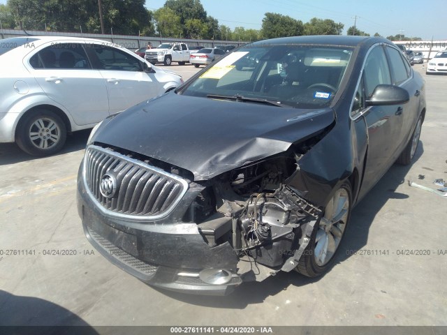 Photo 5 VIN: 1G4PR5SK4F4122468 - BUICK VERANO 