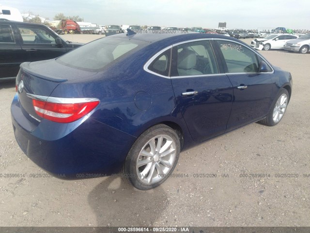 Photo 3 VIN: 1G4PR5SK5D4120287 - BUICK VERANO 