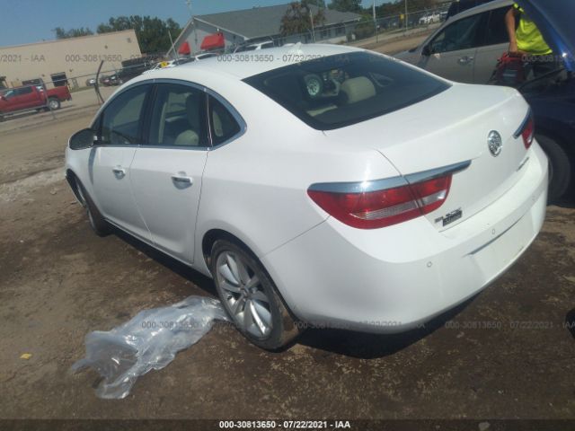 Photo 2 VIN: 1G4PR5SK6E4135611 - BUICK VERANO 