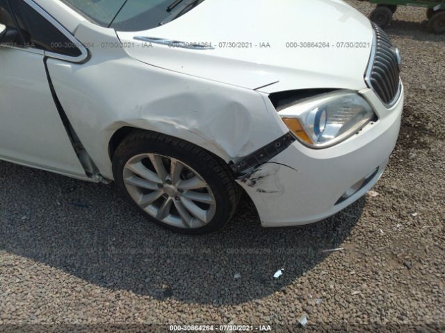 Photo 5 VIN: 1G4PR5SK6F4102691 - BUICK VERANO 