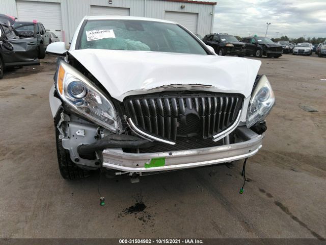 Photo 5 VIN: 1G4PR5SK6F4135187 - BUICK VERANO 