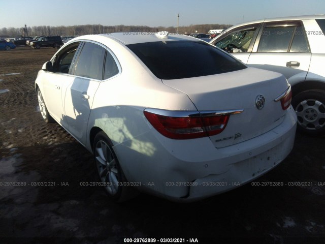 Photo 2 VIN: 1G4PR5SK6F4183742 - BUICK VERANO 