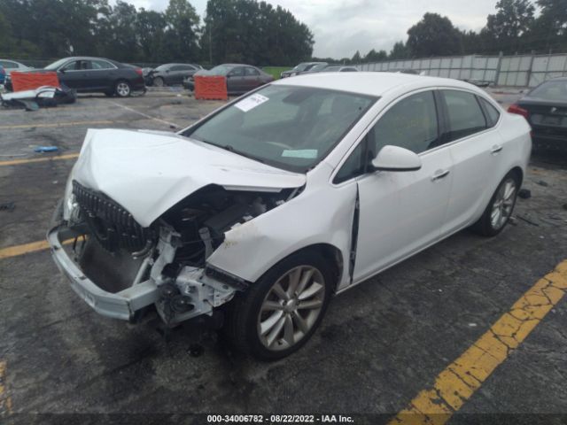 Photo 1 VIN: 1G4PR5SK7D4119450 - BUICK VERANO 