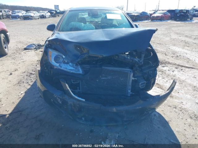 Photo 5 VIN: 1G4PR5SK7E4161554 - BUICK VERANO 