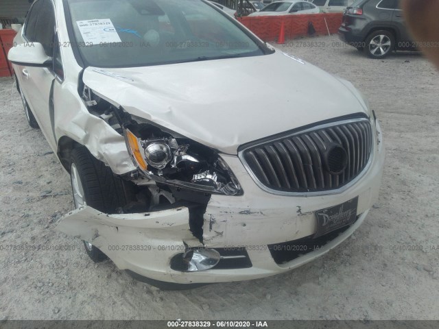 Photo 5 VIN: 1G4PR5SK7E4210140 - BUICK VERANO 