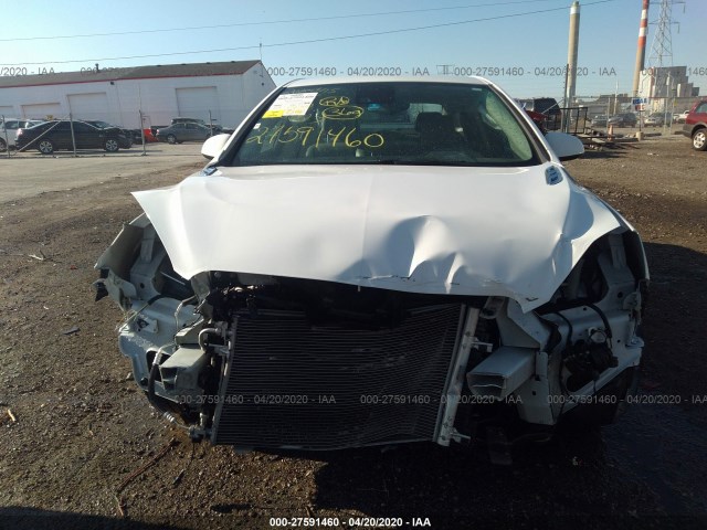 Photo 5 VIN: 1G4PR5SK7F4102327 - BUICK VERANO 