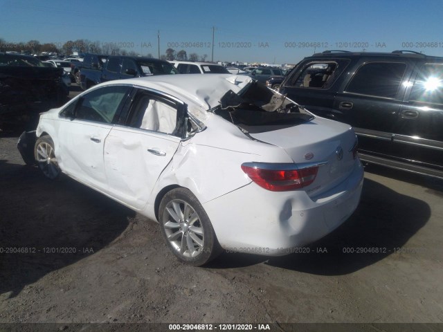 Photo 2 VIN: 1G4PR5SK9E4201293 - BUICK VERANO 