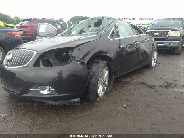 Photo 1 VIN: 1G4PR5SKXC4212557 - BUICK VERANO 