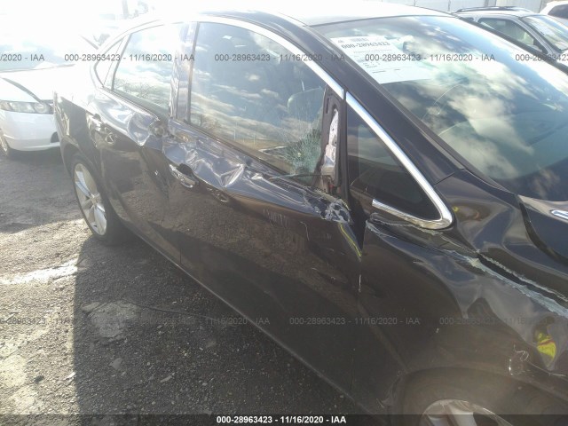 Photo 5 VIN: 1G4PR5SKXE4184116 - BUICK VERANO 