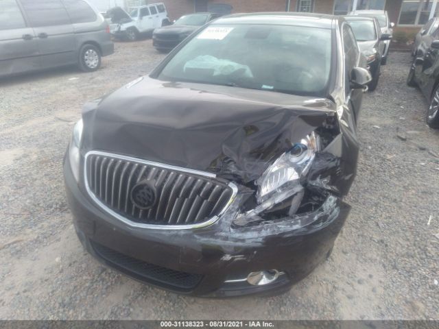 Photo 5 VIN: 1G4PS5SK1D4102969 - BUICK VERANO 