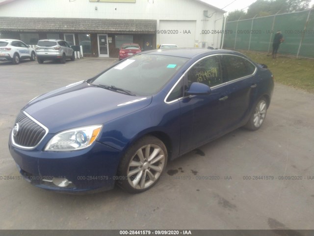 Photo 1 VIN: 1G4PS5SK1D4173637 - BUICK VERANO 