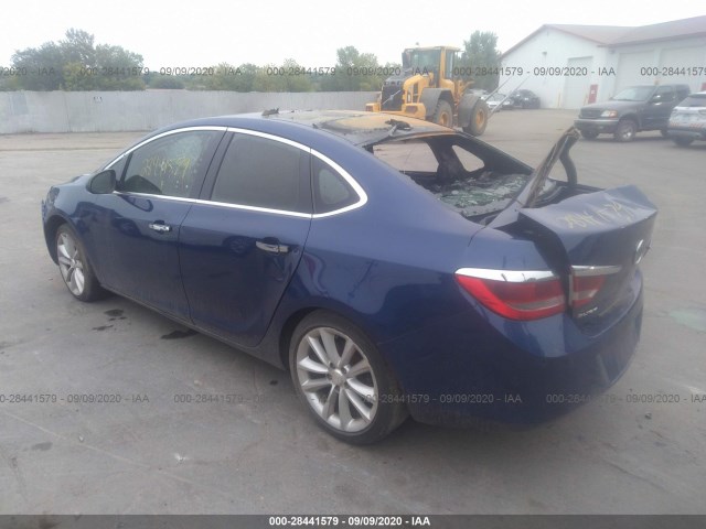 Photo 2 VIN: 1G4PS5SK1D4173637 - BUICK VERANO 