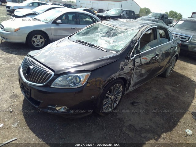 Photo 1 VIN: 1G4PS5SK2E4146481 - BUICK VERANO 