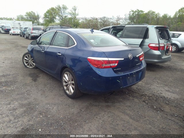 Photo 2 VIN: 1G4PS5SK4D4211409 - BUICK VERANO 