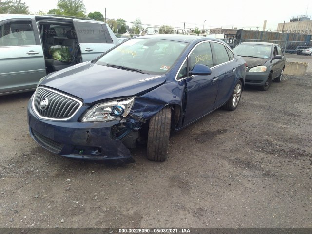 Photo 5 VIN: 1G4PS5SK4D4211409 - BUICK VERANO 