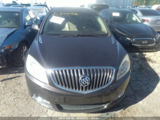 Photo 5 VIN: 1G4PS5SK5C4191038 - BUICK VERANO 