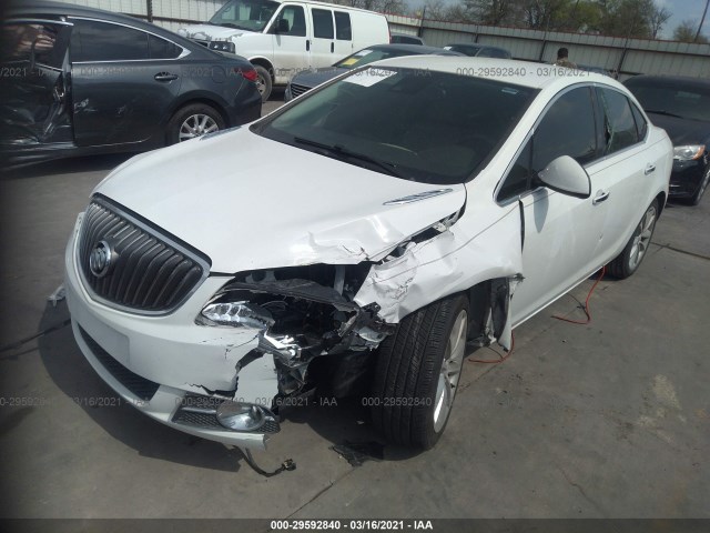 Photo 1 VIN: 1G4PS5SK5E4147463 - BUICK VERANO 