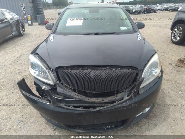 Photo 5 VIN: 1G4PS5SK9D4108776 - BUICK VERANO 