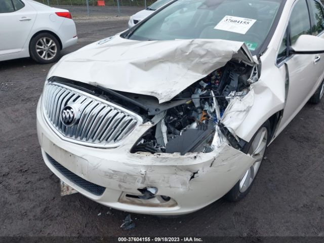 Photo 5 VIN: 1G4PS5SKXG4163340 - BUICK VERANO 