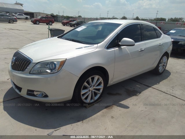 Photo 1 VIN: 1G4PT5SV1D4131914 - BUICK VERANO 