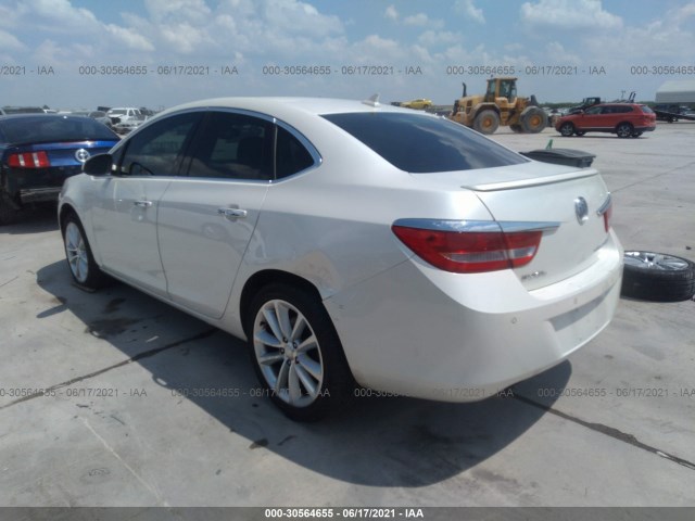 Photo 2 VIN: 1G4PT5SV1D4131914 - BUICK VERANO 