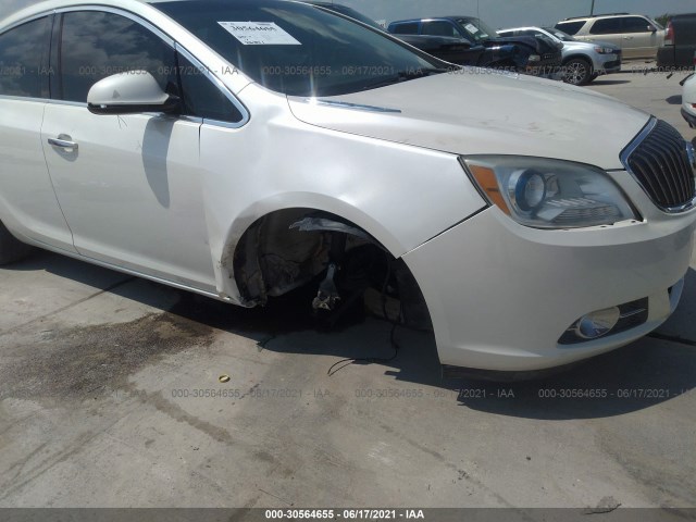 Photo 5 VIN: 1G4PT5SV1D4131914 - BUICK VERANO 