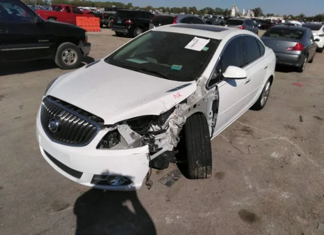 Photo 1 VIN: 1G4PT5SV1E4196070 - BUICK VERANO 