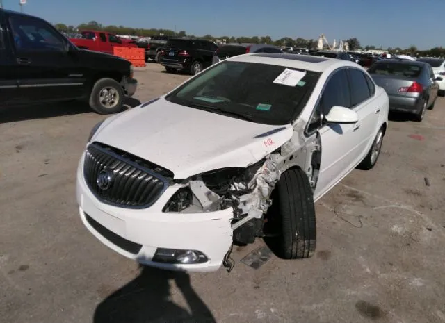 Photo 5 VIN: 1G4PT5SV1E4196070 - BUICK VERANO 