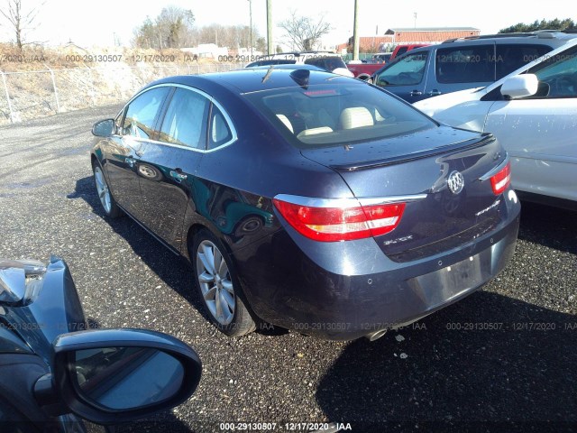 Photo 2 VIN: 1G4PT5SV5G4138613 - BUICK VERANO 