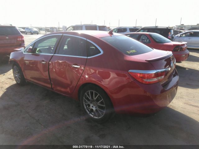 Photo 2 VIN: 1G4PT5SV8E4191643 - BUICK VERANO 