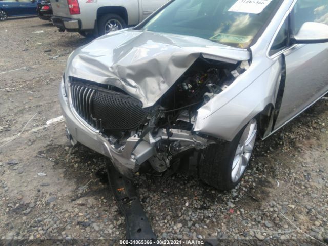 Photo 5 VIN: 1G4PT5SV8E4198236 - BUICK VERANO 