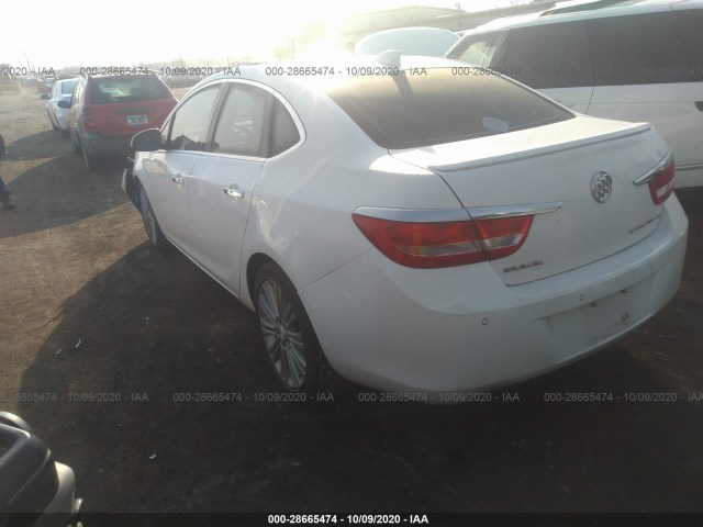 Photo 2 VIN: 1G4PT5SV9G4104836 - BUICK VERANO 