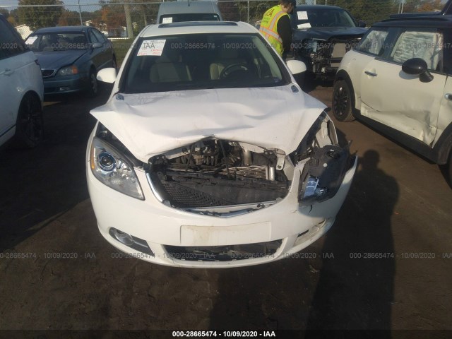 Photo 5 VIN: 1G4PT5SV9G4104836 - BUICK VERANO 