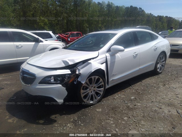 Photo 1 VIN: 1G4ZT5SS0JU131400 - BUICK LACROSSE 