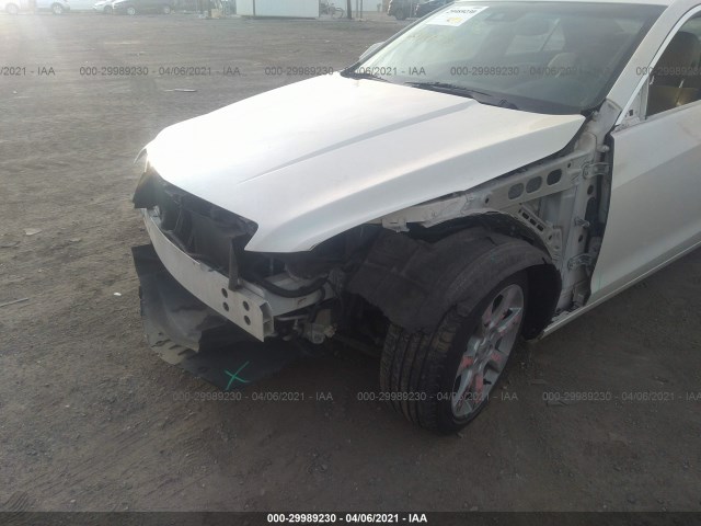 Photo 5 VIN: 1G6AJ5S38D0114262 - CADILLAC ATS 