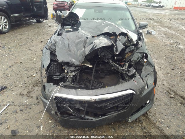 Photo 5 VIN: 1G6AR5SS2J0174033 - CADILLAC CTS SEDAN 