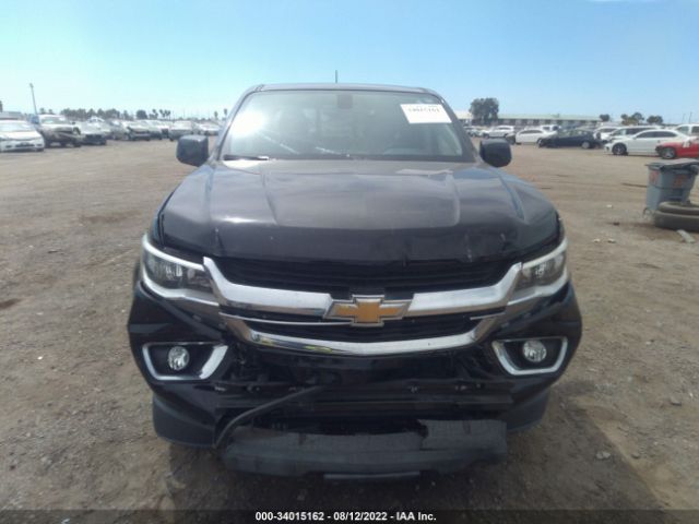 Photo 5 VIN: 1GCGSCEN7J1125491 - CHEVROLET COLORADO 